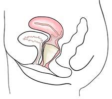 Zo kan je je menstruatiecup steriliseren zonder sterilisator. Oefenen met de menstruatiecup