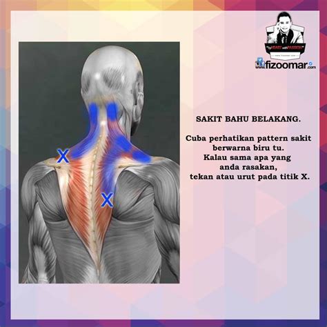 Namun, ada juga sakit leher yang muncul sebagai gejala dari penyakit tertentu. 14 Titik Lenguh Atau Sakit Pada Badan Dan Cara ...