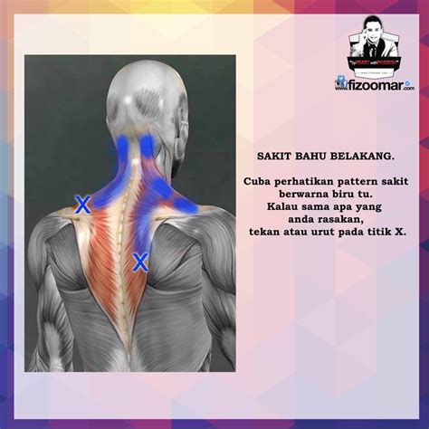 Aspirin, paracetamol dan ibuprofen antara macamana nak dapatkan vitamin untuk bantu atasi masalah sakit kepala dan belakang tengkuk. 14 Titik Lenguh Atau Sakit Pada Badan Dan Cara ...
