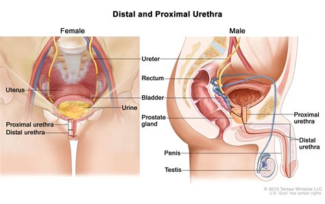 While some women need drugs that feel like liquid fire in their veins, like rowley, others are put on a gentler regimen. Urethral Cancer Treatment (PDQ®)—Patient Version ...
