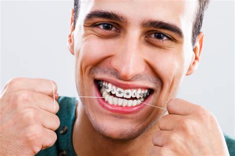 Free braces programs near me for adults. Orthodontist in Charleston, SC | Best Orthodontic ...