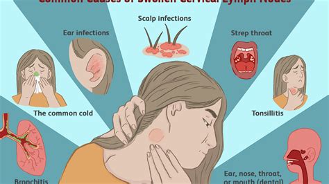 Maybe you would like to learn more about one of these? Posterior Cervical Chain Lymph Nodes Drainage - Best Drain ...