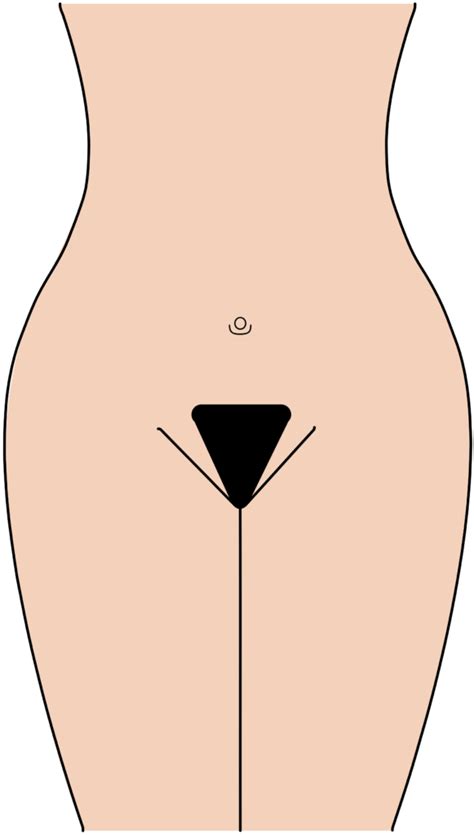 It's not just there to snag in your zipper and ruin your day. Pubic Hair Transplant for Bikini Line Restoration · Bauman ...