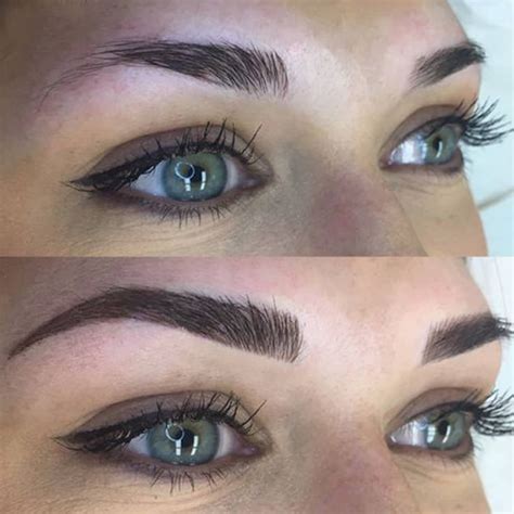 An eyebrow transplant is a life changing investment to your appearance that will last a lifetime. Eyebrow Transplant for Women and Men | Saç, Makyaj ...