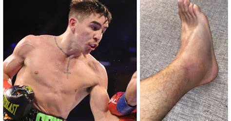 The popular 2016 olympian for the u.k. Michael Conlan reveals ankle injury as Belfast boxer is ...