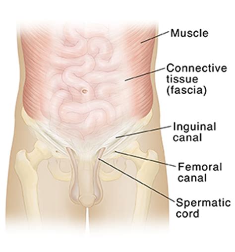 Excess rubbing to the area such as through exercise or sex. Anatomy of the Abdomen and Groin | Saint Luke's Health System