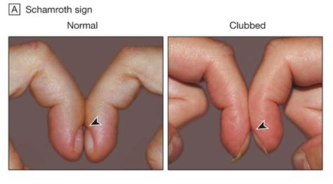 These glands are important to make some essential hormones. Grandmother's Viral Post Explains How Her 'Ugly' Nails ...