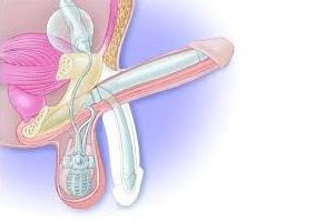 Il commence à s'élever pour une simple hypertrophie cancer est avéré, et agressif, les traitements vous procureront une survie prolongée. Ablation de la prostate, impuissance et problèmes d'érection