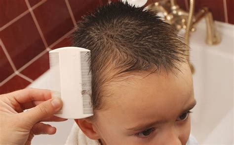 A very clean and effective treatment to eliminate nit eggs in hair is vinegar. How to Get Rid of Head Lice?