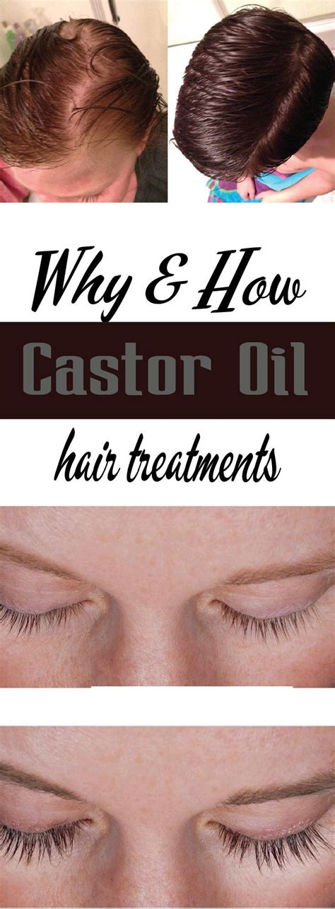 You need to tap into the benefits of castor oil for hair care as described here. Why and How - Castor Oil Hair treatments | Castor oil hair ...