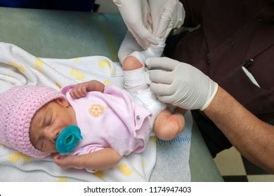 90.000 stichwörter und wendungen sowie 120.000 wichtigste übersetzungen. Club Foot Images, Stock Photos & Vectors | Shutterstock