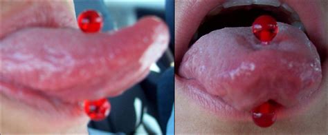 How to clean infected tongue piercing. Tongue piercing - Wikiwand