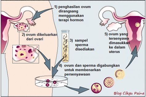 Individu baru yang dihasilkan mempunyai ciri yang sama seperti induk). Blog Cikgu Paine: Penyelidikan Dalam Pembiakan Manusia