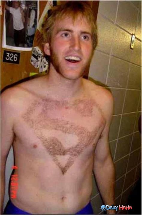 For some men, removing male chest hair fits their lifestyles and personal preferences. Superman Chest Hair