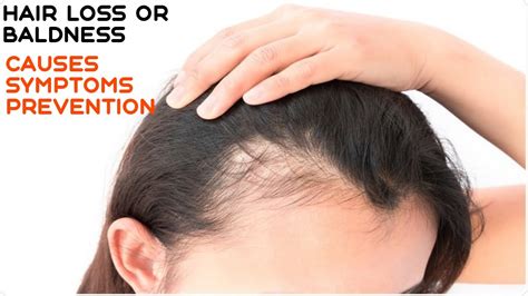 Typically at least the head is involved. Hair Loss OR Baldness. Overview, Causes, Symptoms ...