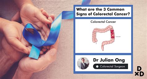 2 if you have risk factors, like a family history of colon cancer, you should discuss any symptoms with your doctor. Warning! These are 3 Common Signs of Colorectal Cancer ...