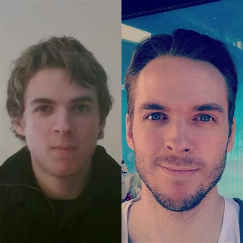 Believe it or not, facial hair can yield some real benefits besides serving as a mere fashion statement. (17-29) I don't miss not having any facial hair ...