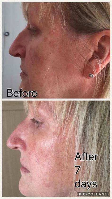 I did cleanse sometimes, i did tone sometimes, i always used a moisturiser, but i never really found one system. Trulum Skincare - Fitness With Ulrika