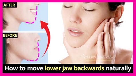 This is a device that wraps around the chin and lower jaw, preventing it from growing. How to fix underbite, protruding jaw, move lower jaw ...