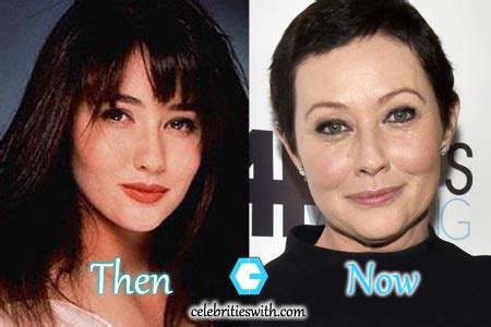 Get the latest shannen doherty news, articles, videos and photos on the new york post. Shannen Doherty Plastic Surgery: Before After Fillers ...