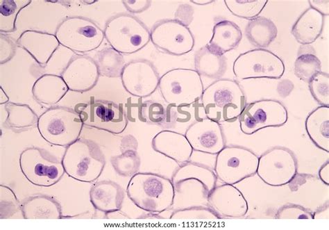 Mitosis is the process in which a eukaryotic. Meiosis Animal Cell Under Microscope Education Stock Photo ...