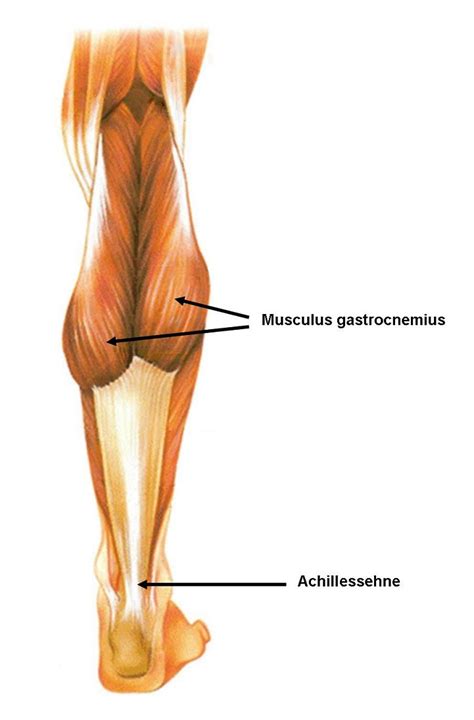 Beschwerden an der achillessehne ( achillodynie) sind besonders bei sportlern sehr häufig. Sehnenentzündung achileenne - Oxa Médical