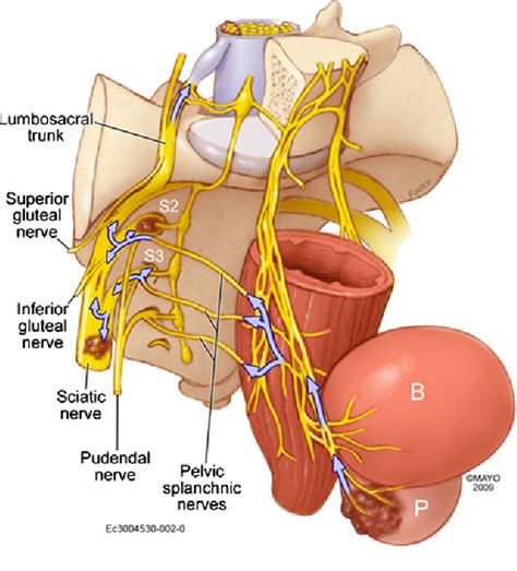 Having children at an early age and having multiple children reduces the risk of ovarian. Figure 8 from Adenocarcinoma of the prostate involving the ...