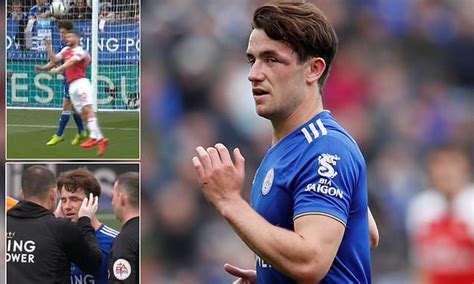 We will update you as soon as. Ben Chilwell suffers nasty black eye after clash with ...