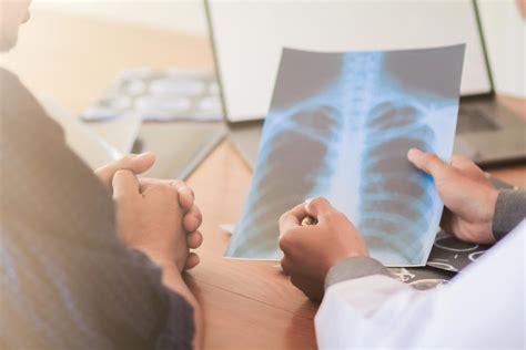How long will your dog live? Can Lung Cancer Ever Go Away? | Lung Cancer Lawsuit ...