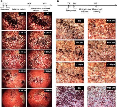 Umr is a unitedhealthcare company. Mineralization in the UMR-106 osteoblastic cell line after a 24-h U(VI)... | Download Scientific ...