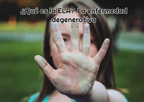 La enfermedad suele manifestarse mediante fasciculaciones musculares y debilidad en una la ela afecta aproximadamente a 5 de cada 100 mil personas, por lo que en la argentina se calcula que. ¿Qué es la ELA? La enfermedad degenerativa | Librezale