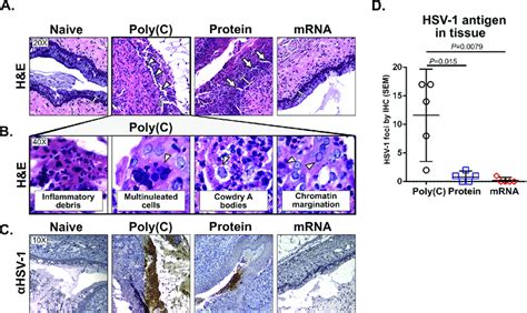 The focus for this hot topic is discontinuation of hsv igm serologic testing at mayo clinic laboratories. Histopathology and immunohistochemistry four days after ...