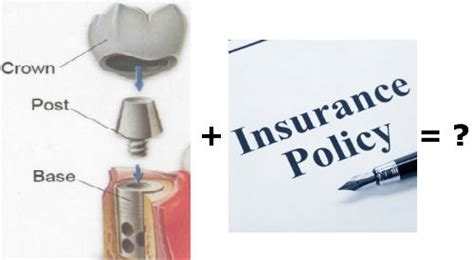 Ppo, indemnity, individual, family, senior. Dental Implant Insurance: 12 Options That Save You Money...