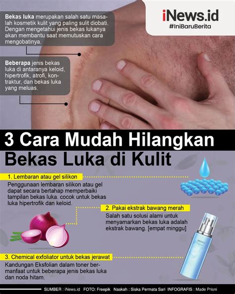 Maybe you would like to learn more about one of these? 3 Cara Menghilangkan Bekas Luka di Kulit, Salah Satunya ...