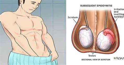 Many men do not tell their health care surgery is the main treatment for testicular cancer. Mesmerizing words: 5 Signs Of Testicular Cancer Most Men ...