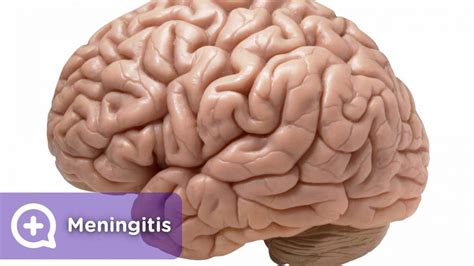 Bacterial meningitis and meningococcal septicaemia. Meningitis, ¿origen vírico u origen bacteriano? - mediQuo