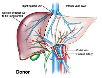 Computer science notes in hindi. How Much Does Liver Transplant Cost In India - We Care India