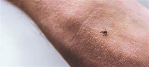 Maybe you would like to learn more about one of these? Chigger Bites (+ 5 Natural Home Remedies for Chigger Bite ...