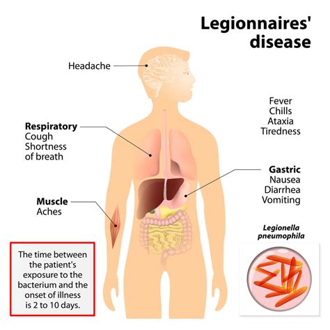 La légionellose tire son nom d'une épidémie ayant eu lieu en 1976 à philadelphie lors du 58ème plus de 90% des cas de légionellose impliquent la bactérie legionella pneumophila qui fait partie de. Bacterial Diseases | 12 common diseases that are caused by ...