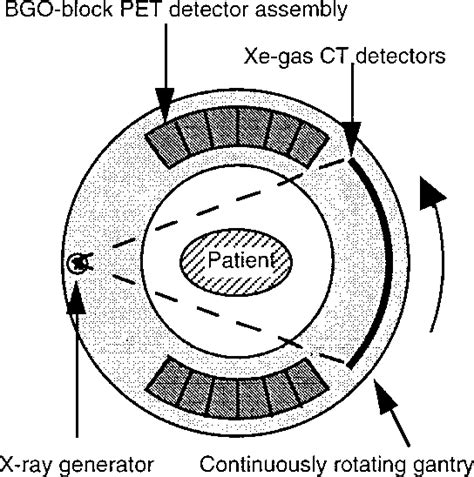 The biggest problem is when scattered photons end up in a detector. Illustration of the PET/CT scanner operational principles ...