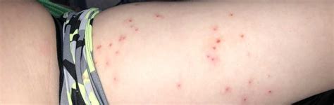 Symptoms can include fever, rash, eye irritation, swollen hands or feet and belly pain. 'This is also COVID': Woman says her 8-year-old tested positive for coronavirus, displayed ...