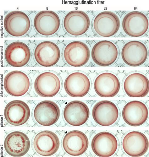 Fimbriae carry adhesins which attach them to the substratum so that the bacteria can withstand shear forces and obtain nutrients. Blocking of Dr fimbriae-dependent agglutination of human ...