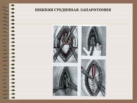 Диета при лапароскопия желчного