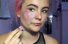 makeup bruises