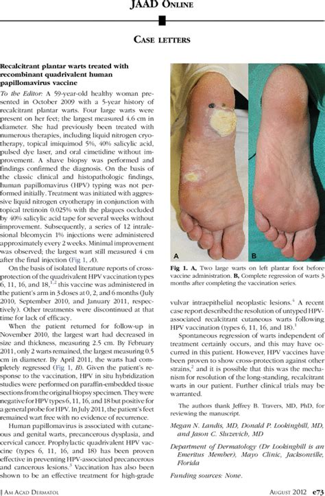 Every year, as many as 2 million persons present with plantar heel pain,1 with men and women affected equally.2 plantar fasciitis is the most common cause of. Recalcitrant plantar warts treated with recombinant ...