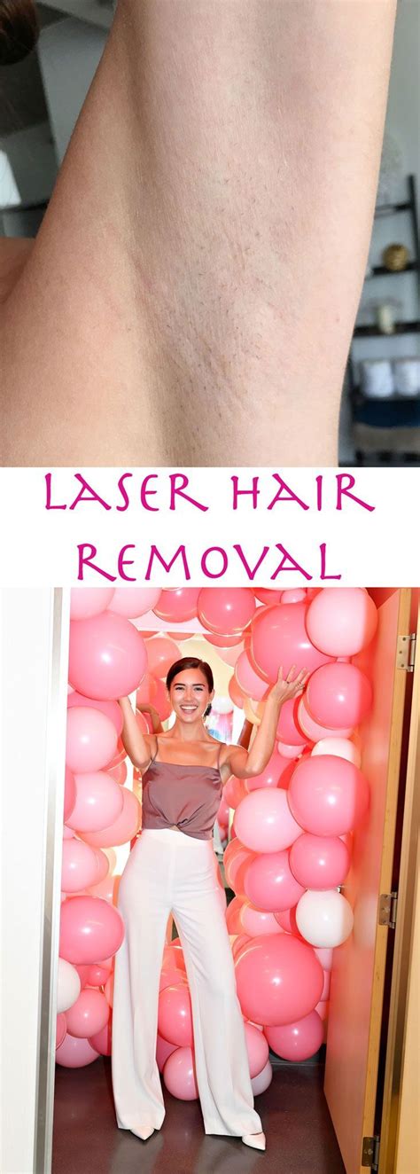 How does laser hair removal work? hair removal at home remedies: SHOULD I DO LASER HAIR ...