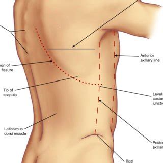 It encloses the thoracic cavity, which contains the lungs. Surface Anatomy Of Ribs - 7 Surface Anatomy : Bony ...