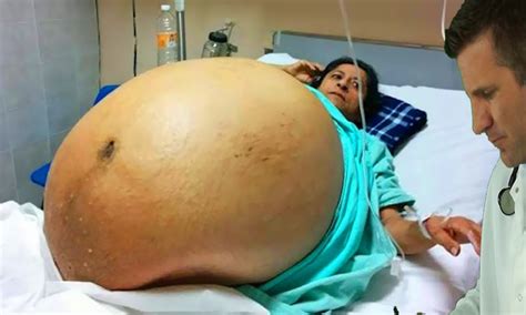 Indian woman miscarries 10 babies in one night. 10 Men/Woman You Won't Believe Actually Exist! - YouTube