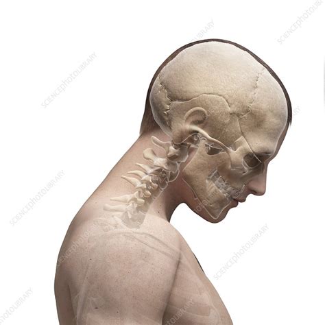 At the base of my neck/top of my spine there is a bony lump there that has not gone away and it causes a. Human skull and neck bones, artwork - Stock Image - F010 ...