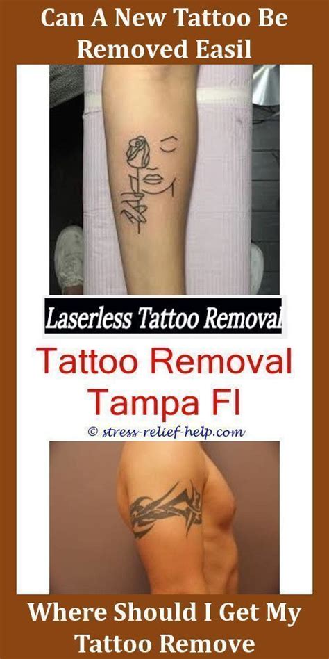 Your tattoo, especially if it's more than just line work, is going to be scabby by this point. Tattoo Removal Near Me Is Tattoo Removal Worth It How Much ...